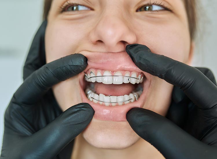 patient with retainer on