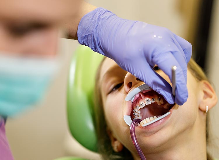 dentist working on child's braces