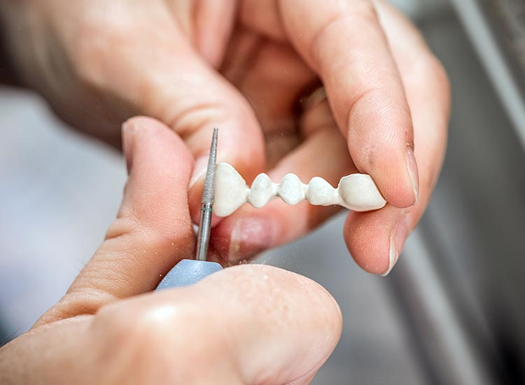 dentist shaving veneer model
