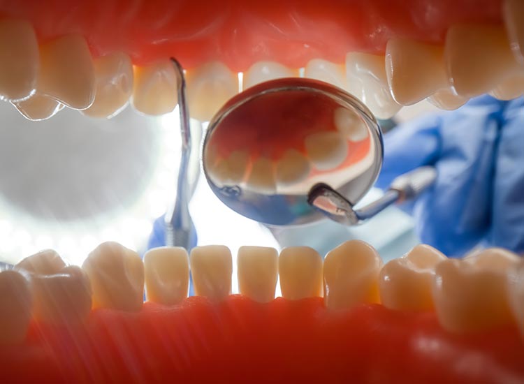 dentist checking for cavities