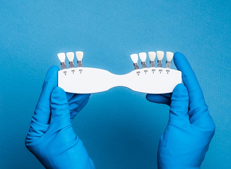 dentist holding veneers