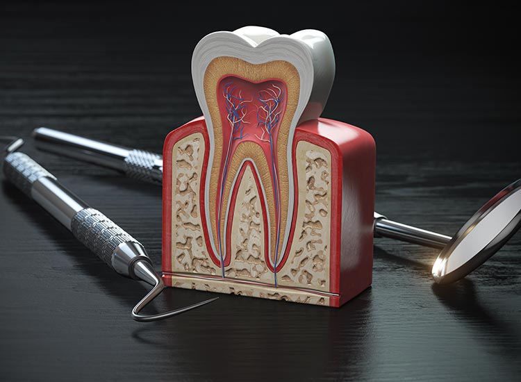 root canal model