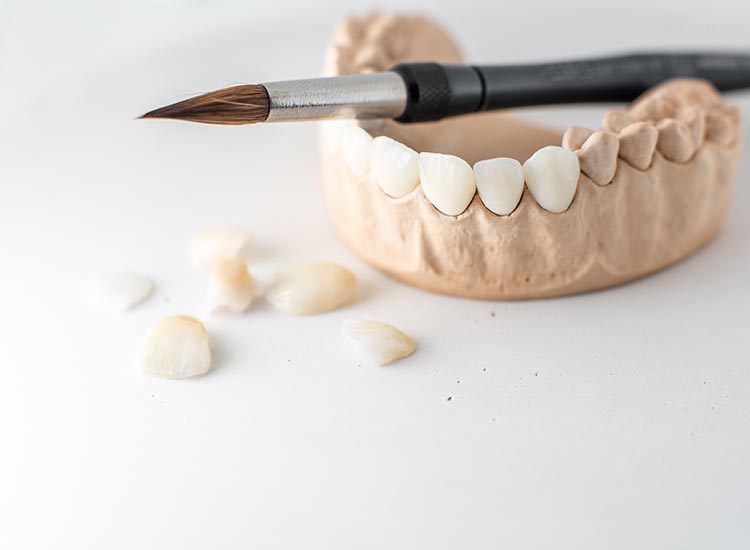 mouth model
