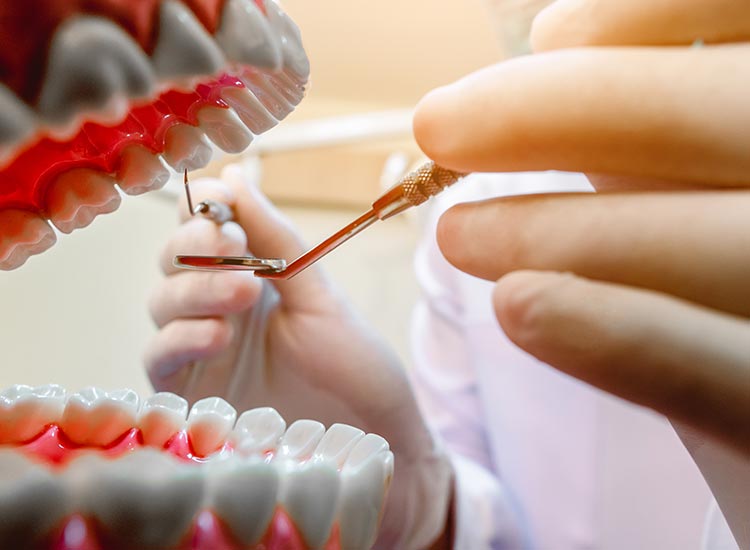 dentist checking for cavities