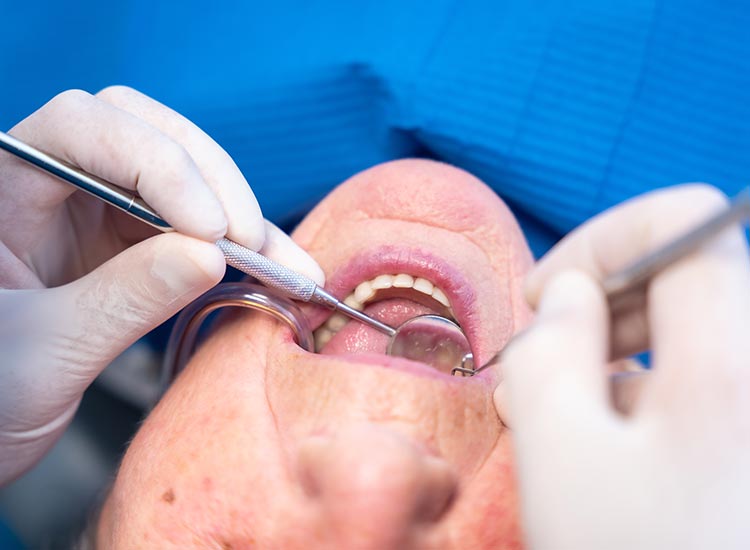 dentist checking back of patient's teeth