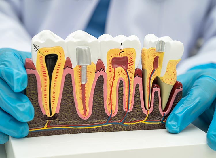 teeth model of different types of dentistry