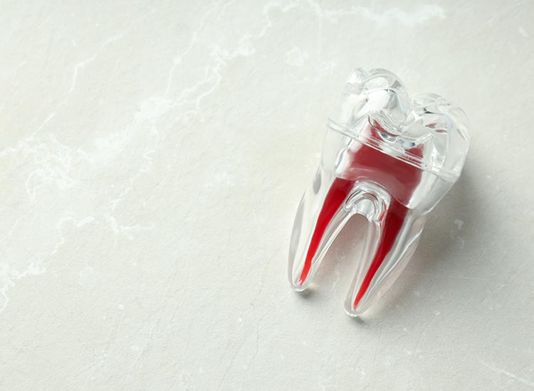model of the inside of the tooth