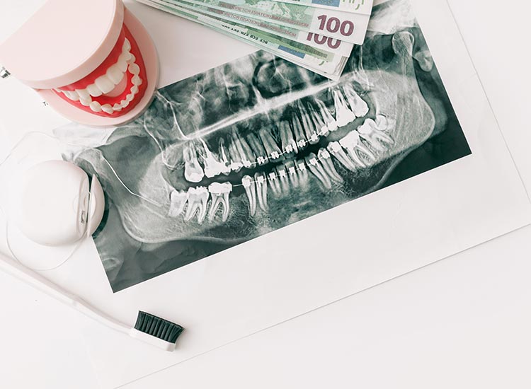 photo of x-ray and money