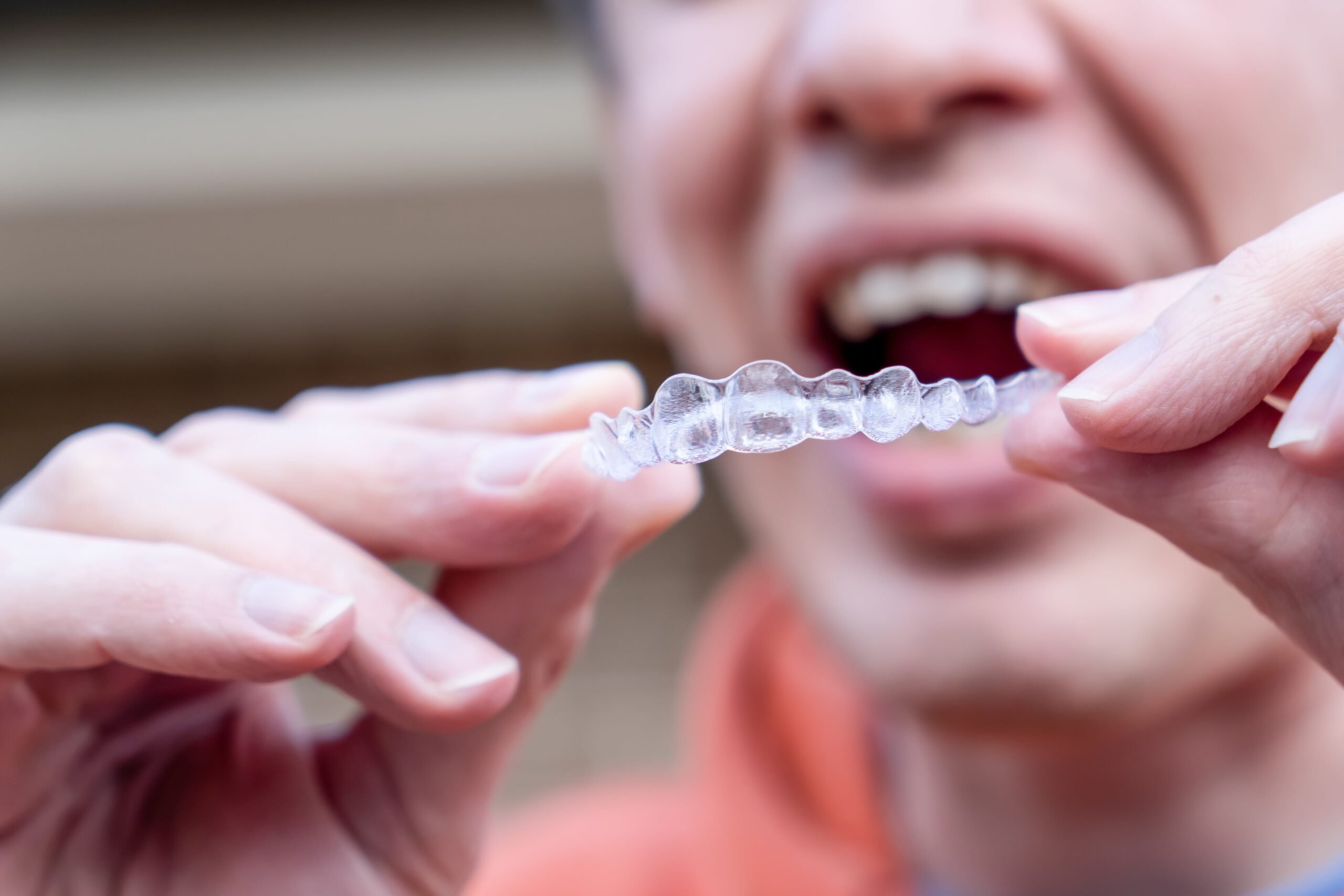 man holds put on invisible braces