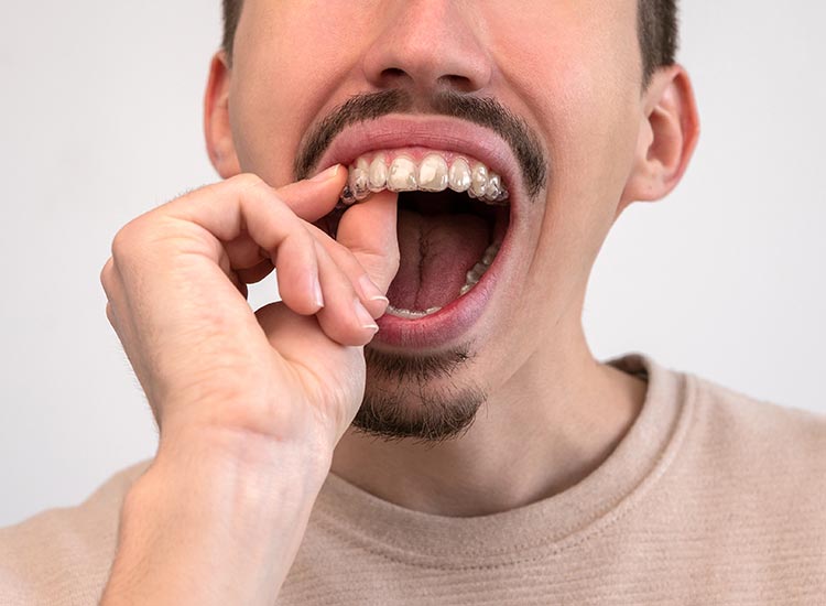 person putting on a mouth guard
