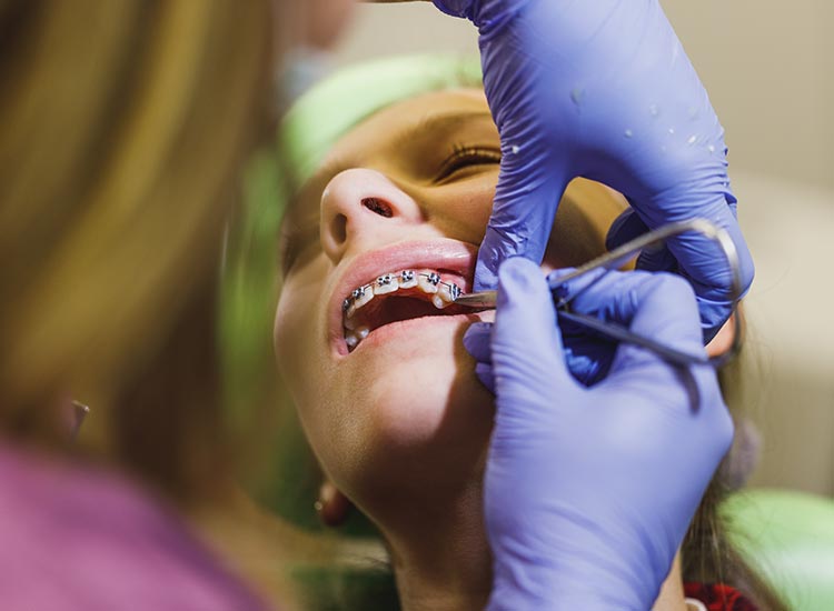 dentist working on patients braces