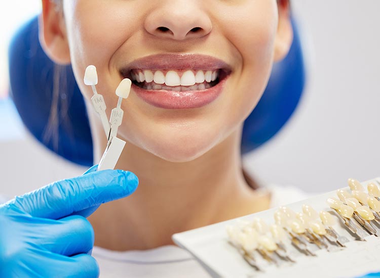 dentist showing patient veneer color options