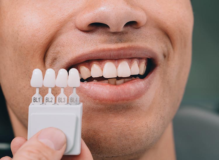 patient selecting veneers color