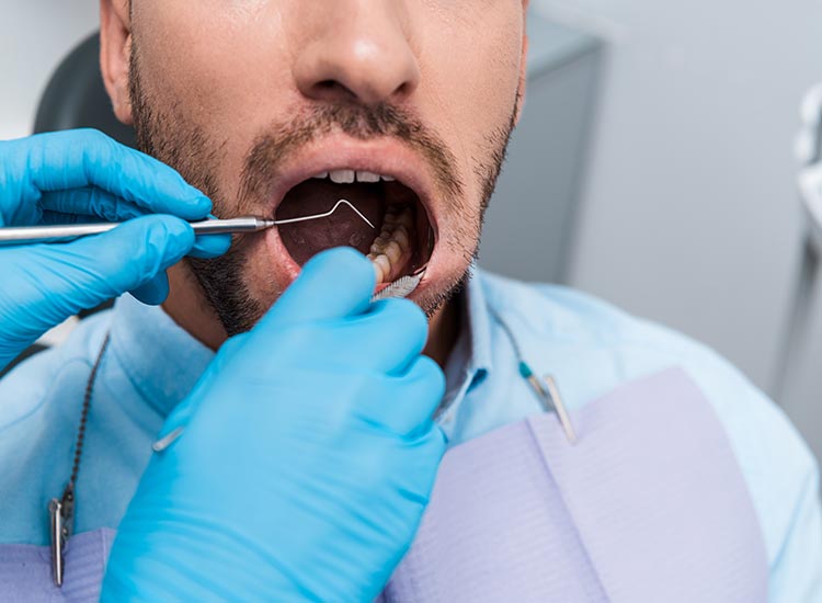 dentist checking for cavities